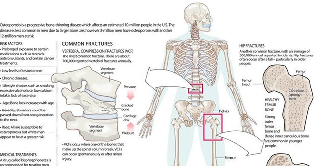 8311b2c3e7de7965ed5606aa32f8b2b9--strong-bones-juicing-for-health.jpg