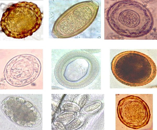 Collage_of_various_helminth_eggs (1).png