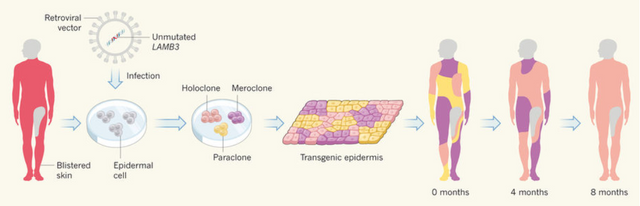 skin-treatment-stem-cells.PNG