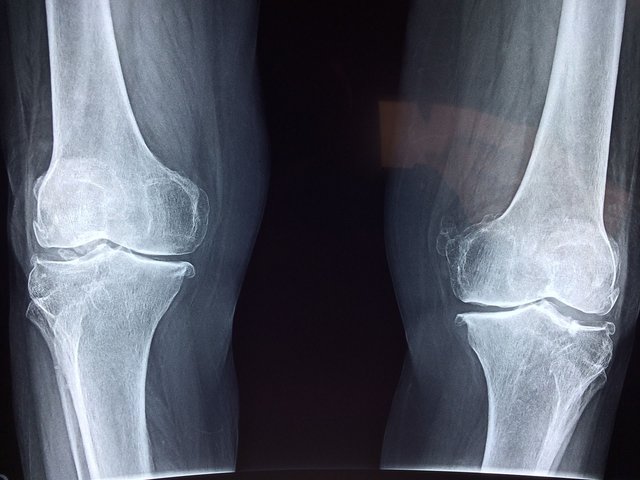 knee-2253047_1920.jpg