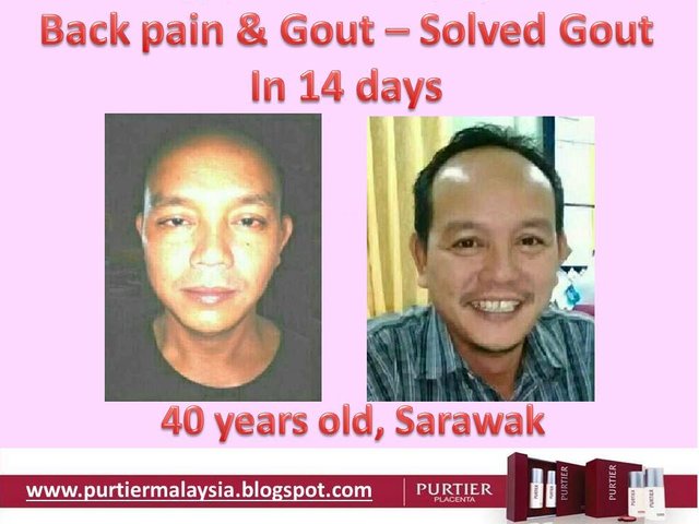 back pain gout purtier placenta sarawak.jpg