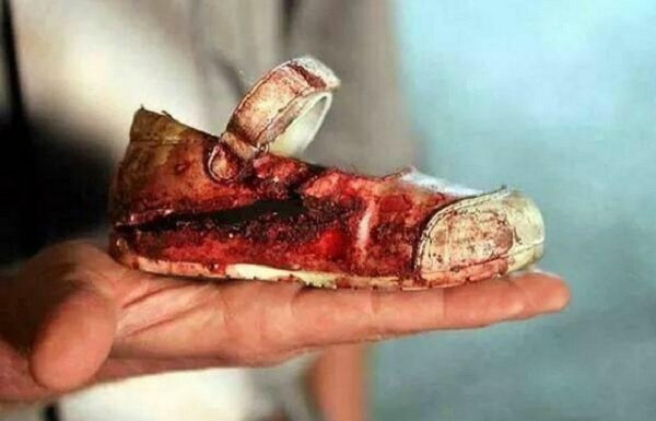 hoax-claimed-that-image-bloodied-shoe-little-girl-was-taken-peshawar-attack.jpg