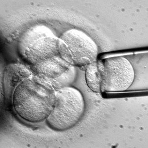 celulas-madre-embrionarias-300x300.jpg