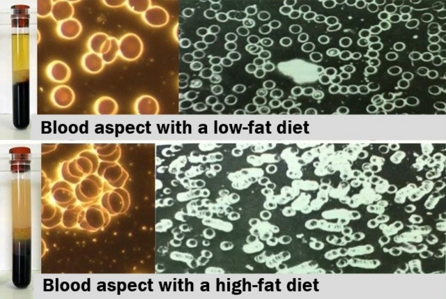 blood aspect for fatty blood and non fatty blood.png