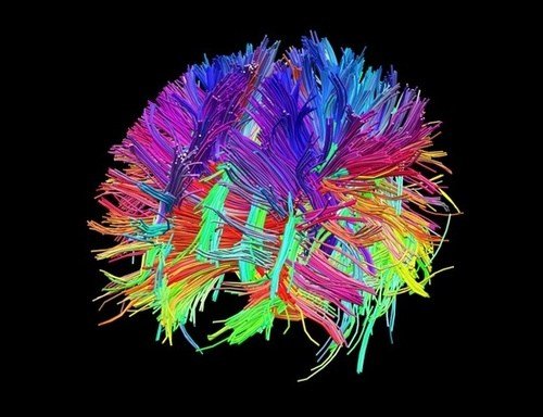 connectome-diffusion-spectrum-image-Human-Connectome-Project.jpg