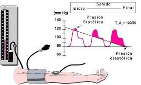 Una presión arterial sistólica de 140 mm hg o una presión diastólica de 90 mm hg o más es