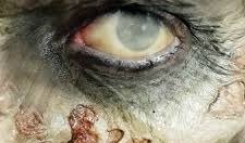 zombie eye crop.jpg