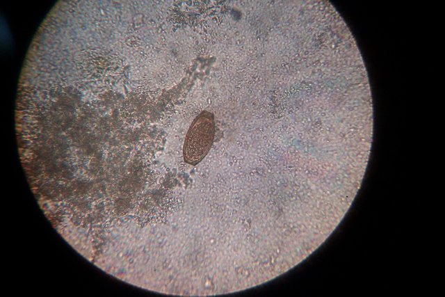 OVA OF TRICHURIS TRI.jpg