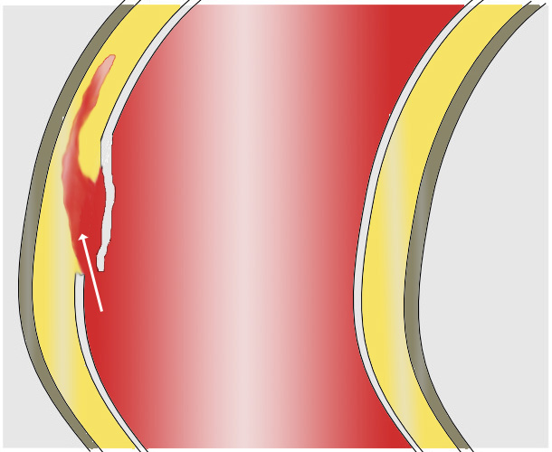 AoDissect_Schema_01a.png