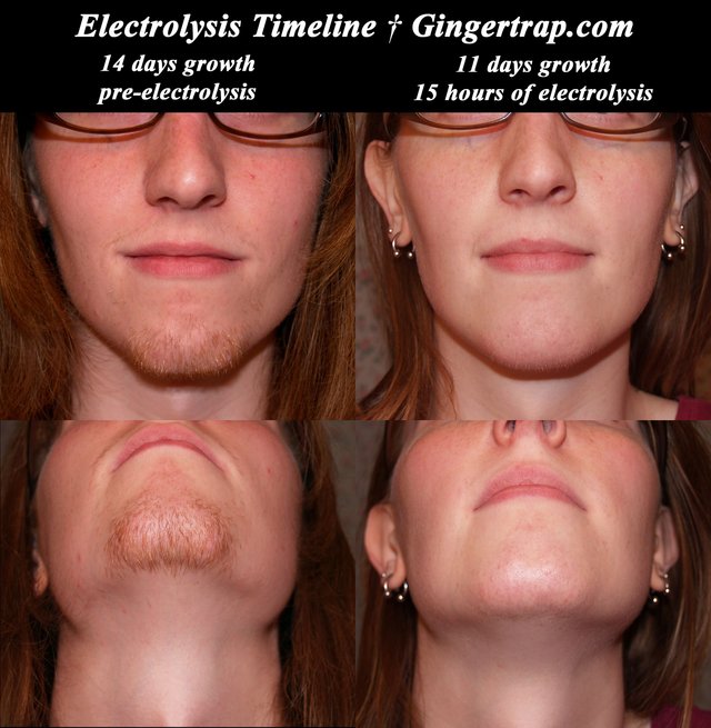 electrolysis-timeline.jpg