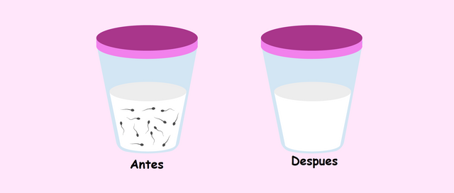 Ausencia-de-espermatozoides.png