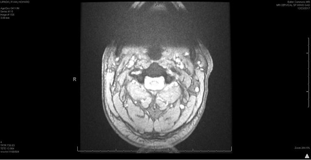 cervical 4.jpg