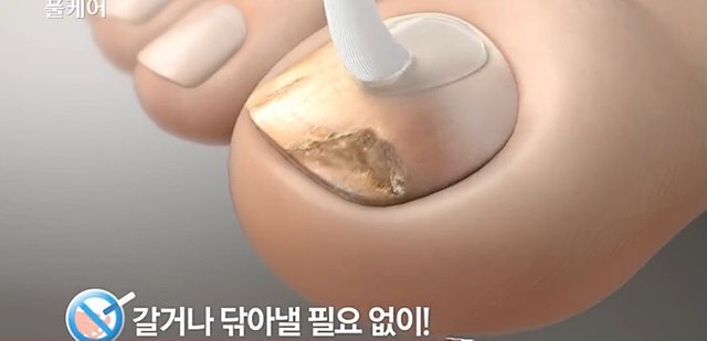 풀케어2.jpg