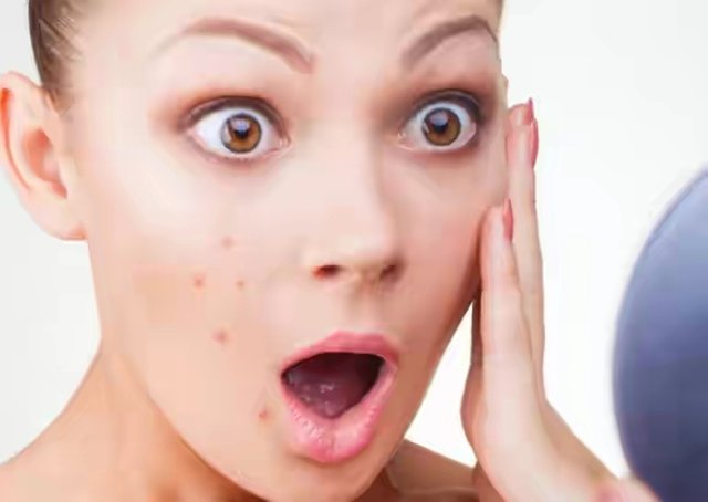 Get-Rid-of-Pimples-768x545.jpg