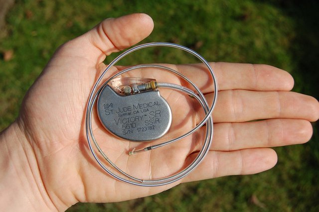 1280px-St_Jude_Medical_pacemaker_in_hand.jpg