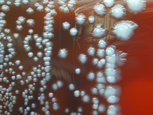 yersinia pestis forming colonies on sheep blood culture cdc PHIL_1921.jpg