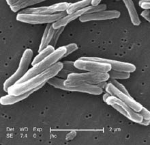 Mycobacterium_tuberculosis.jpg