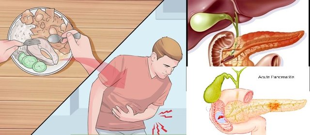 aid7675945-v4-728px-Differentiate-Acute-Pancreatitis-from-Similar-Conditions-Step-2-1024x448.jpg