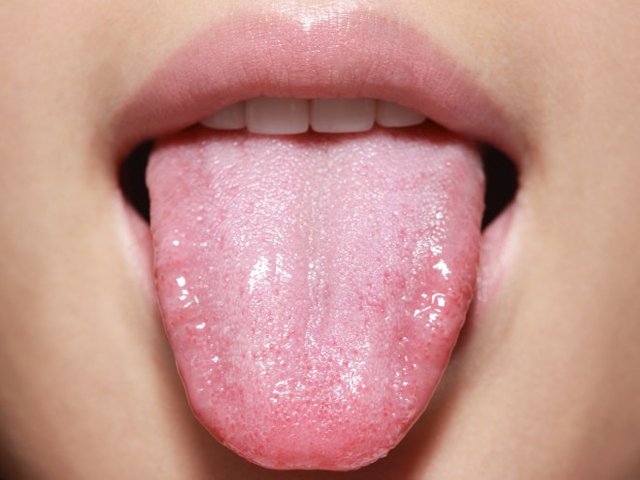 Tongue-GettyImages-130898101-1280x960-660x495.jpg