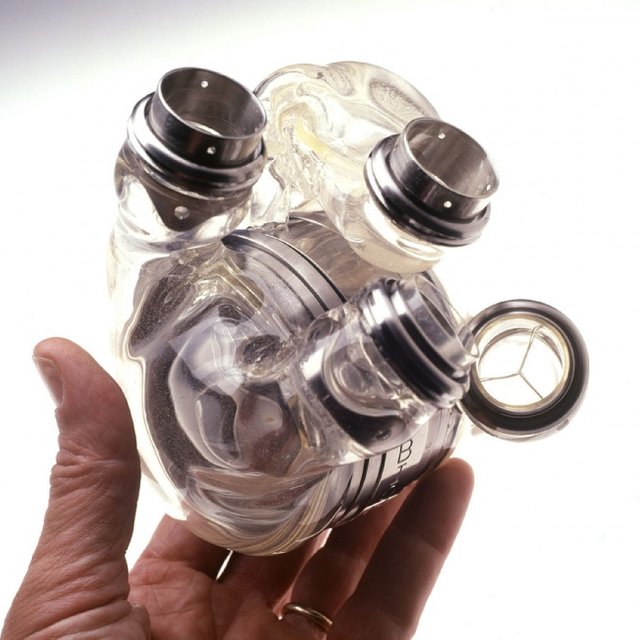 5251260-AbioCorArtificialHeart-1510685801-650-271560cfac-1512985529.jpg