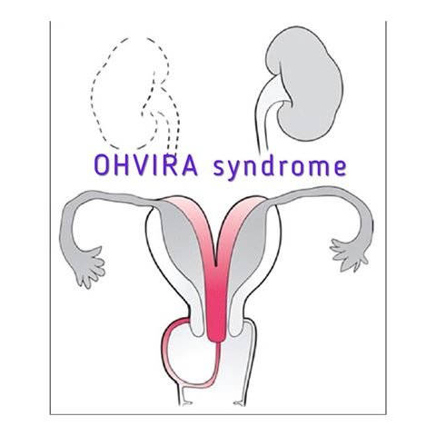 OHVIRA Syndrome.jpg
