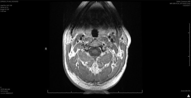 cervical 8.jpg