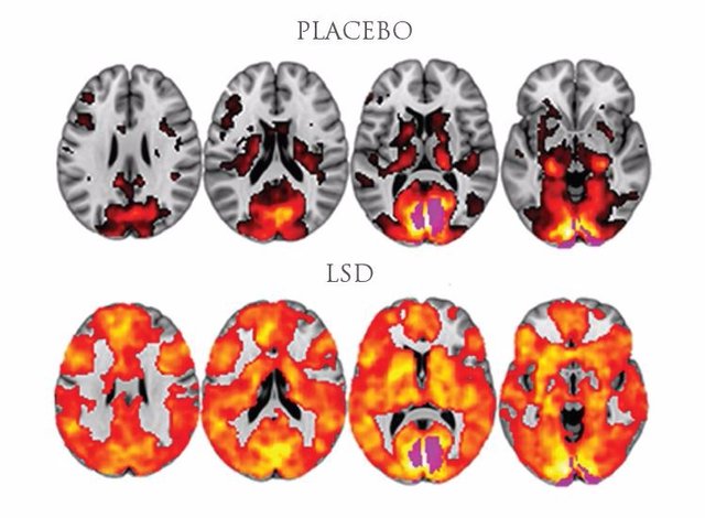 placebo-lsd.jpg