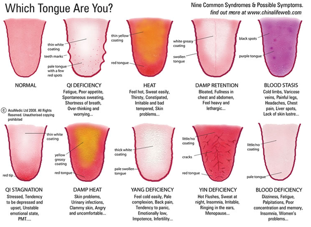 tongue guide