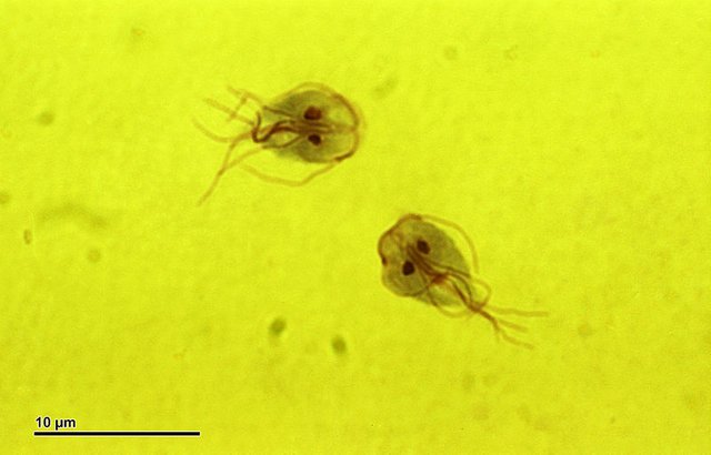 Archivo:Giardia intestinalis (259 17).jpg