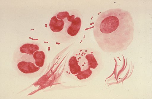 Neisseria gonorrhoeae PHIL 3693 lores