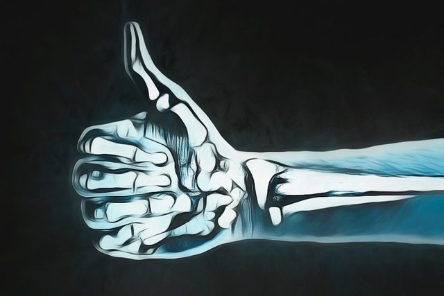 xray hand