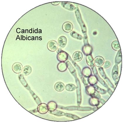 Candida albicans