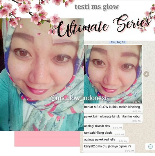 testi ultimate series