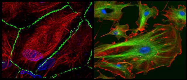 Stained cytoskeleton in cells