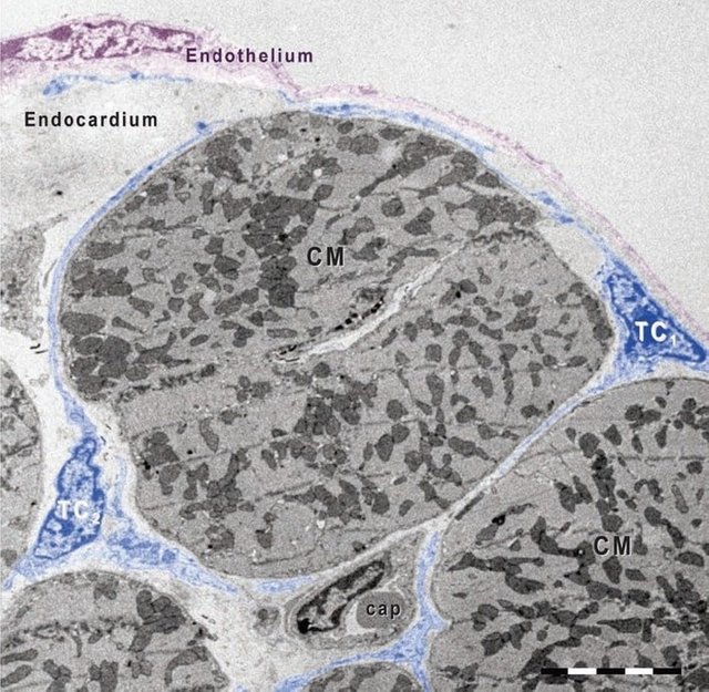 Network of Telocytes (in blue) surrounding cardiac cells.