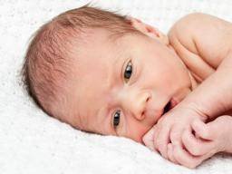 Causes and treatments of infant jaundice