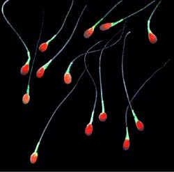 Low sperm count: Symptoms and Causes