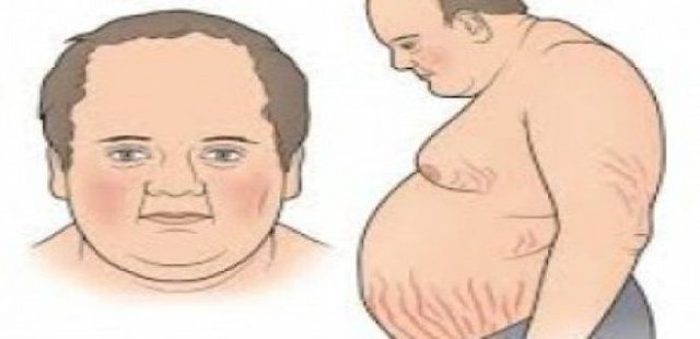 Treatment Of Cushing's Syndrome