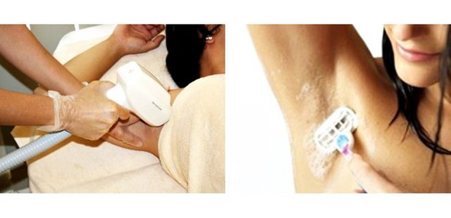 Hair removal with 