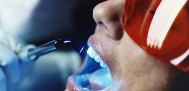  Teeth Whitening Methods