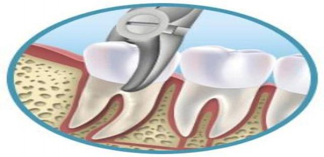 Diagnosis and planning phase