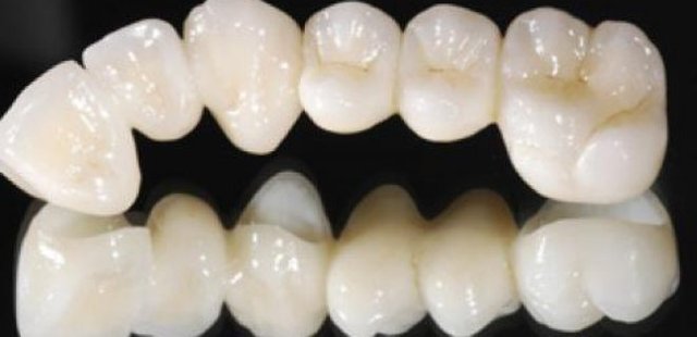 What Is Dental Zirconium