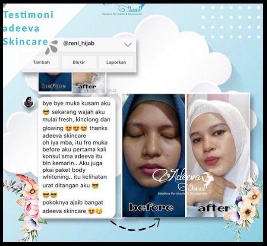 testimoni adeeva skincare