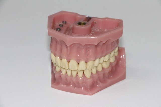 dentures-1514697_960_720a958b.jpg