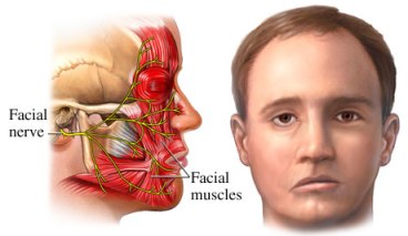facial-nerve-and-muscle-diagram-8-1.jpg