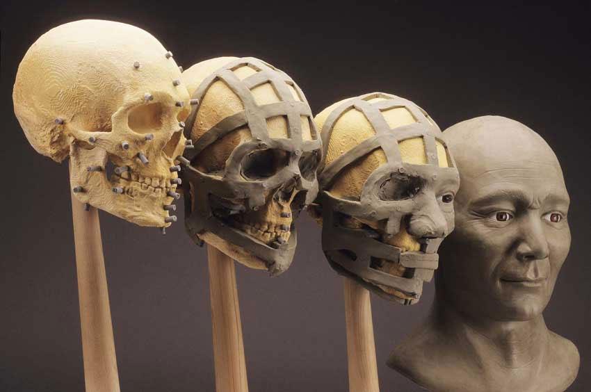 facial-bone-reconstruction1.jpg