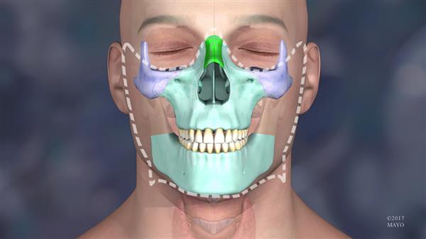 32-year-old-undergoes-successful-face-transplant-thanks-3d-printing-mayo-clinic-5.jpg