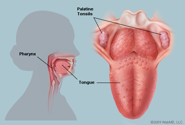 Tonsils_72.jpg