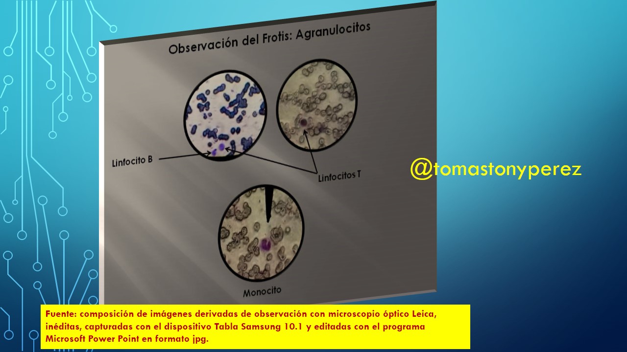 Observación_Agranulocitos.JPG