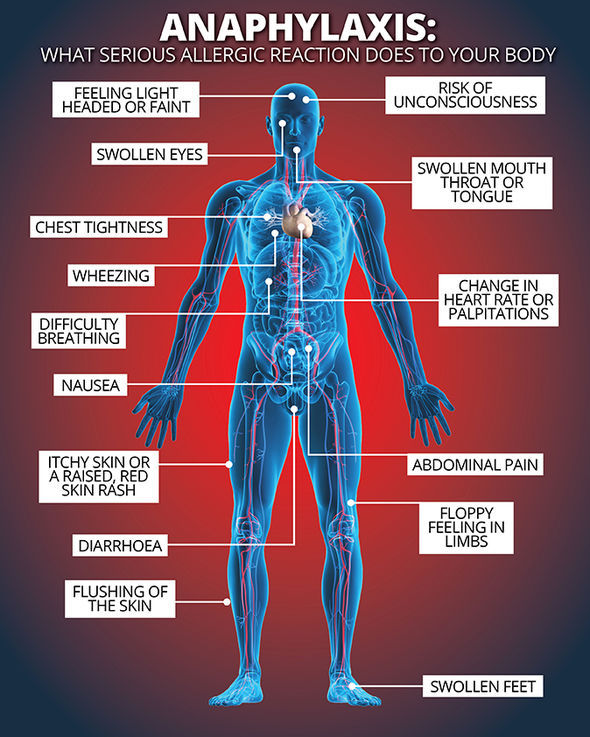 Symptoms-of-anaphylactic-shock-649095.jpg